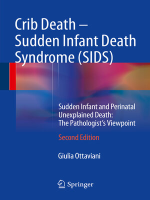 cover image of Crib Death--Sudden Infant Death Syndrome (SIDS)